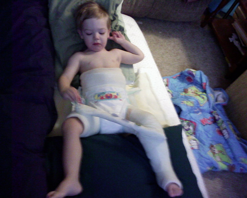 cast 2 first day home